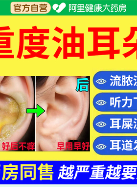 重度油耳朵清洁器专用儿童成人耳屎耵聍软化止油发炎流脓水滴耳液