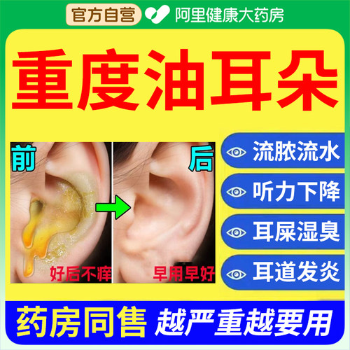 重度油耳朵清洁器专用儿童成人耳屎耵聍软化止油发炎流脓水滴止痒