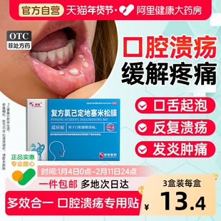 口腔溃疡贴专用药嘴巴上火起泡口舌生疮醋酸地塞米松口腔贴膜非散