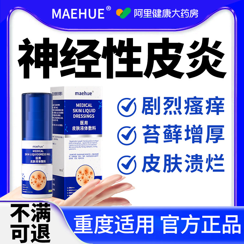 神经性皮炎治顽固无激素疗皮肤病去祛真菌感染癣藓除瘙痒外用膏