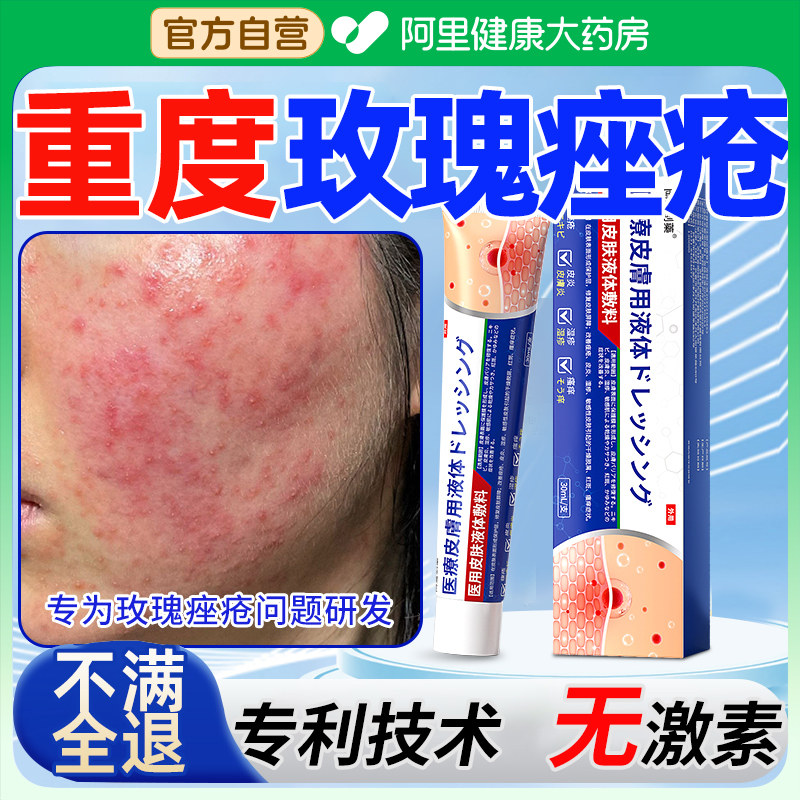玫瑰痤疮敏感肌屏障修复脸部泛红特酒糟鼻红血丝丘疹脓包专用乳膏