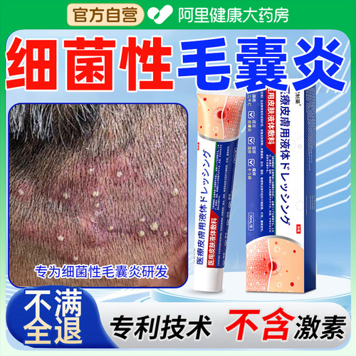 药膏控油去屑