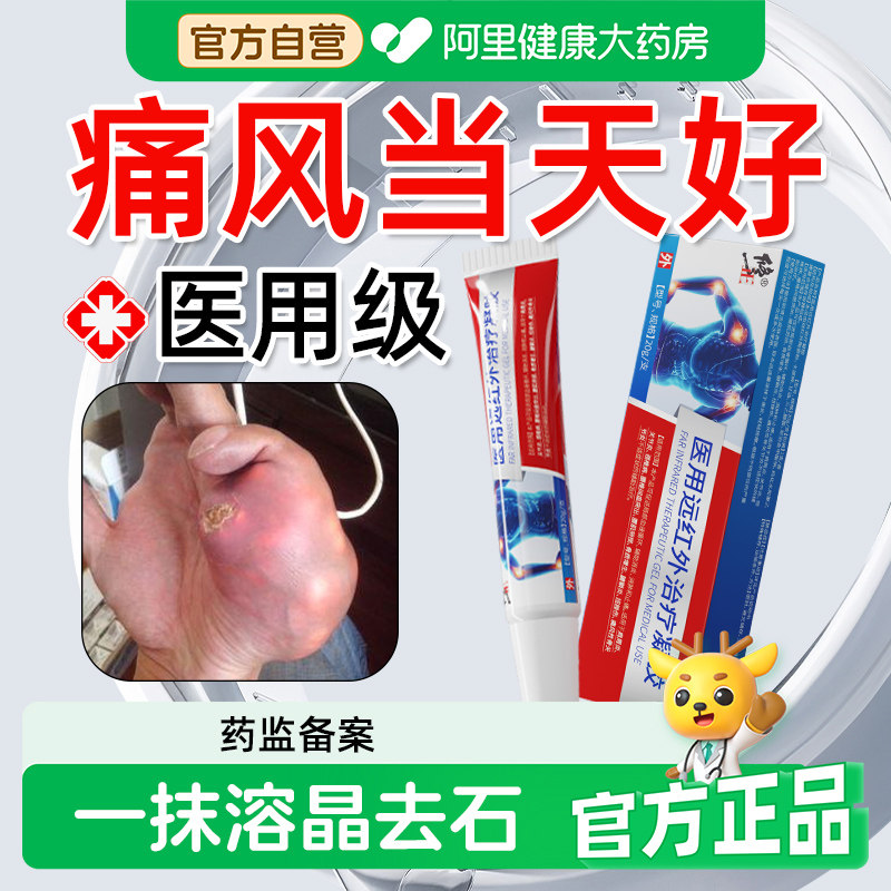 治痛风止痛溶石贴膏降尿酸溶石去结晶冷敷凝胶专用关节疼消肿特效