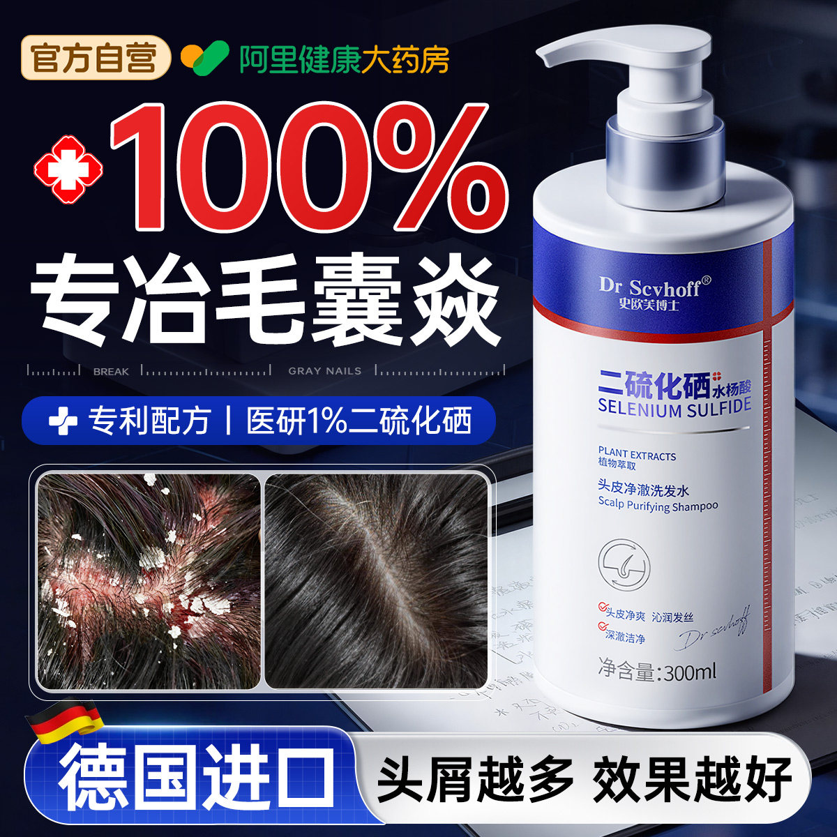 二硫化硒洗发水液去屑止痒控油蓬松脂溢性皮除螨焱毛囊洗剂洗发露