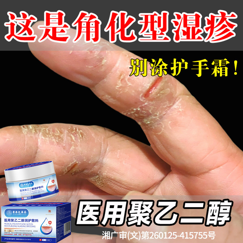 手指裂口出血专足跟治开裂手足皲裂膏角化型起硬皮干燥脱皮修复霜,医疗器械,医用乳膏（器械）,淘宝优惠券,粉丝福利购,淘宝优惠卷