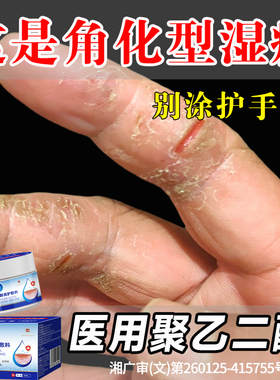 手指裂口出血专足跟治开裂手足皲裂膏角化型起硬皮干燥脱皮修复霜