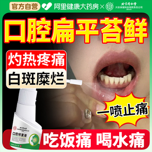 口腔扁平苔藓专用喷雾剂治疗白斑舌头糜烂粘黏膜溃疡纤维化修复液