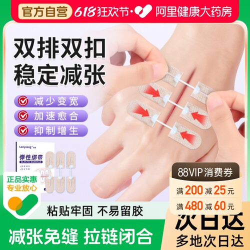 医用减张器剖腹产甲状腺减张贴术后疤痕伤口减张愈合拉链式免缝合