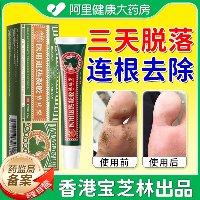 香港宝芝林跖疣膏寻常疣鸡眼趾足部根立净去除疣脚底专用药膏正品 医疗器械 针灸器具（器械） 原图主图