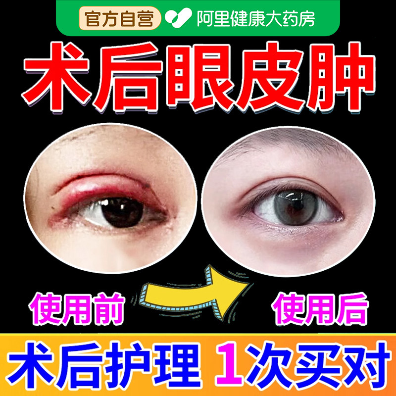 双眼皮术后消肿神器热敷眼罩缓解眼部疲劳专用眼贴冰冰敷医用冷敷