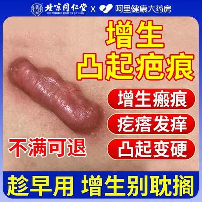 【药房直售】祛除增生凸起疤痕