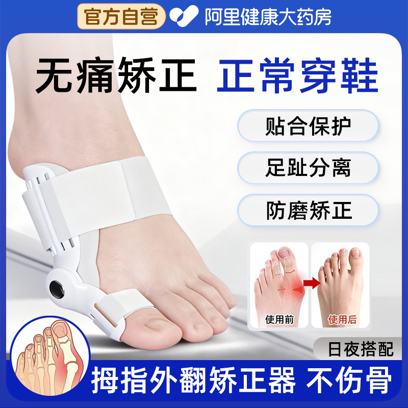 脚趾矫正器拇指外翻女士分离大脚骨突出神器分大母趾头足指姆矫形