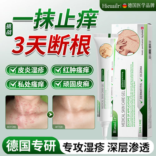 湿疹药膏外用止痒皮炎药膏肛周肛门阴囊瘙痒去顽固皮炎汗疱疹软膏