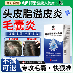 脂溢性皮炎头皮毛囊炎洗特效头部专用头皮痒有疙瘩特去屑止痒抑菌