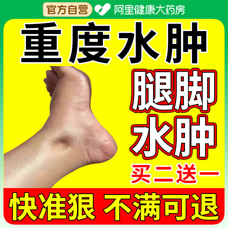 消肿去水肿专用老人脚肿下肢浮肿活血化瘀止痛利水利尿排药贴神器