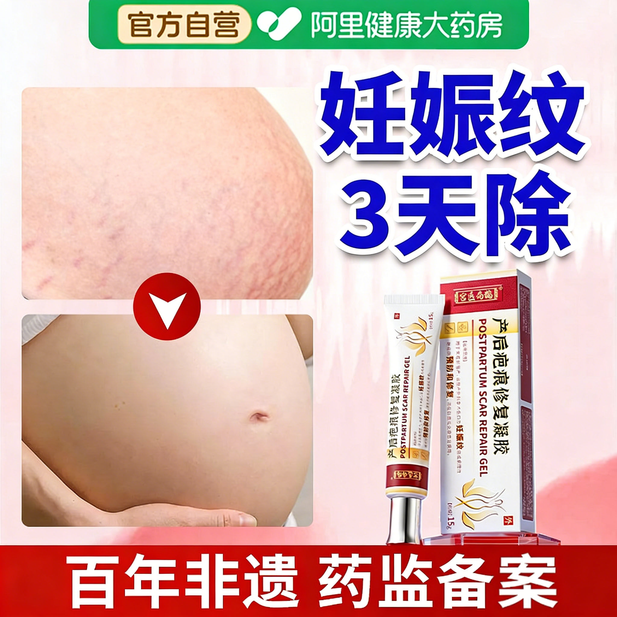 医用祛妊娠纹妊辰纹产后消除去妊娠纹紧致肚皮油孕妇专用修复霜膏