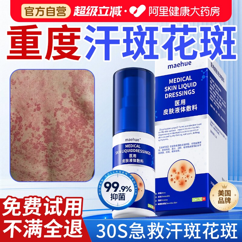 汗斑花斑癣专用祛治腋下皮肤褐斑消白斑抑菌效搭沐浴露医用净膏
