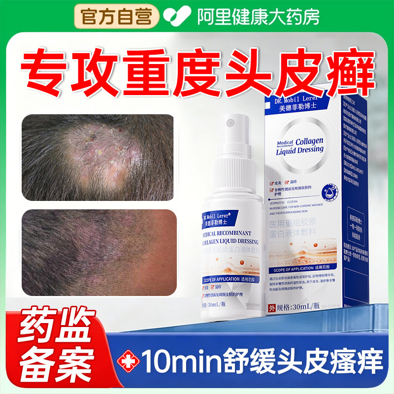 头皮癣专脂溢性皮炎药膏牛皮癣银屑病用头上长痘痘疙瘩头癣毛囊炎