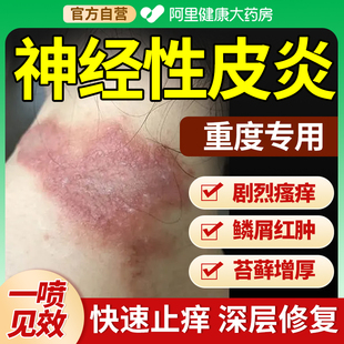 神经性皮炎治疗外用喷剂顽固皮肤病癣藓湿疹真菌感染膏根祛去除