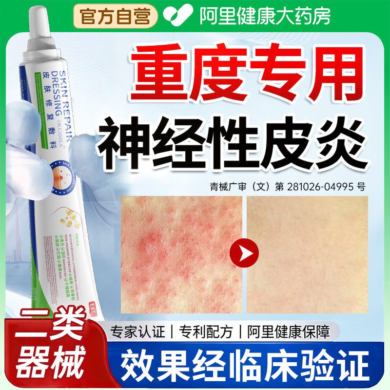 神经性皮炎去除外用膏皮肤病癣藓湿疹真菌感染的专用顽固