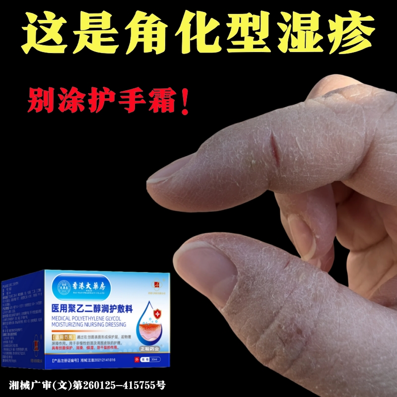 角化型手足裂口出血修复霜专足跟治开裂手足皲裂膏起硬皮干燥脱皮