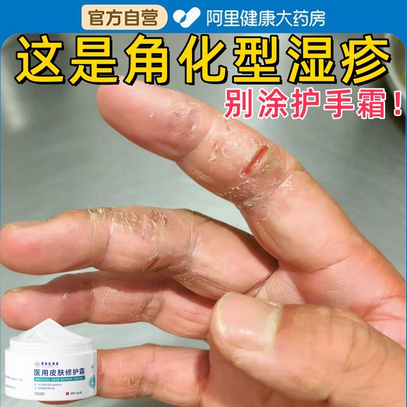手指裂口出血角化型修复霜专足跟治开裂手足皲裂膏起硬皮干燥脱皮,医疗器械,医用乳膏（器械）,淘宝优惠券,粉丝福利购,淘宝优惠卷