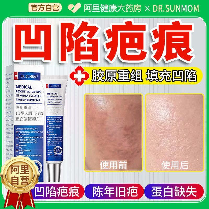 凹陷性疤痕修复水痘脸上伤疤擦伤摔伤除疤膏填充黑色素祛疤凝胶