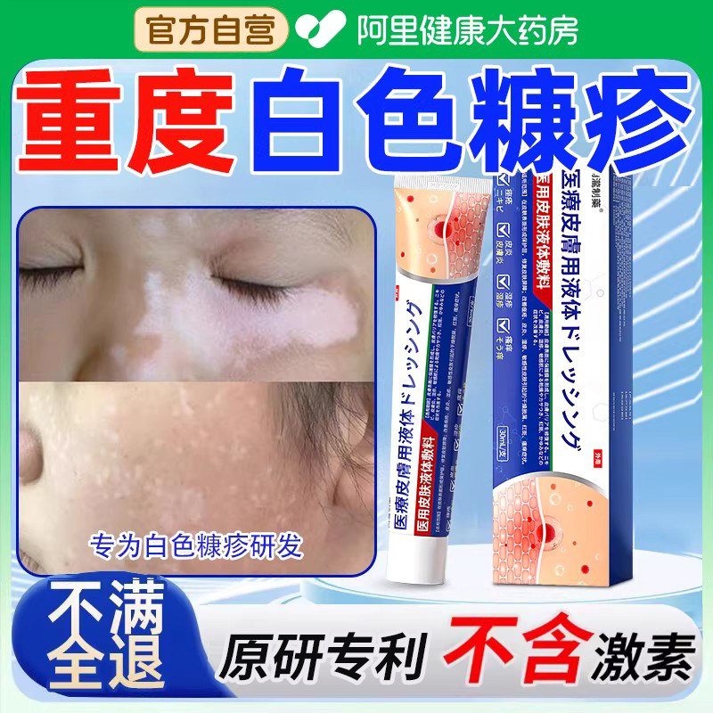 白色糠疹药膏儿童脸上长白斑皮肤干燥止痒汗斑花斑癣脸部皮肤抑菌