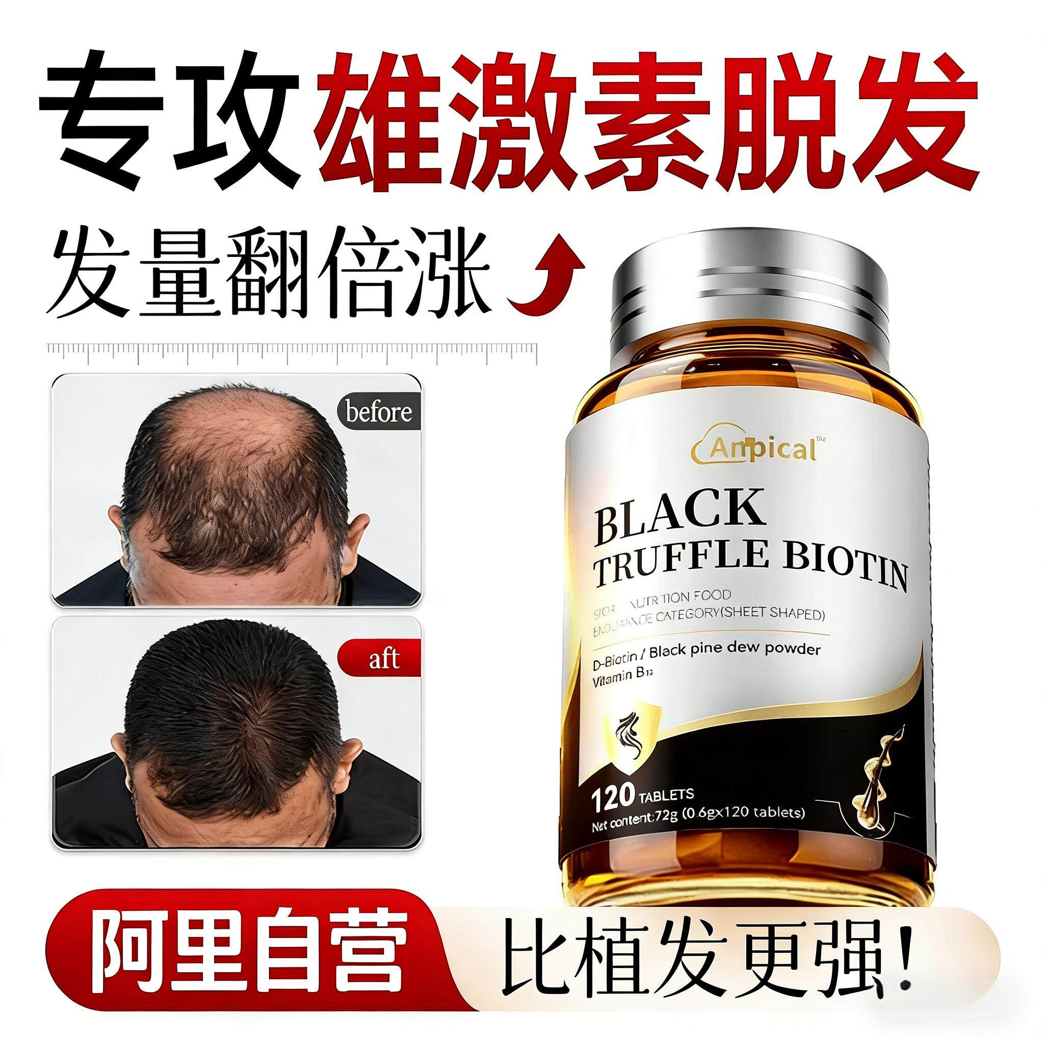 雄性激素脱发生物素生发治疗严重男专用防脱发复合维生素片