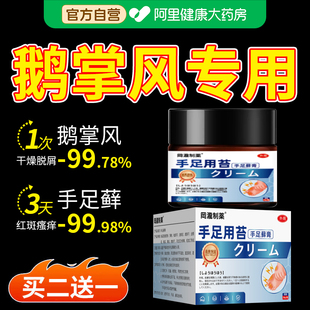 鹅掌风专用手癣膏药治疗手掌干开裂脱皮汗疱疹真菌感染角化型湿疹