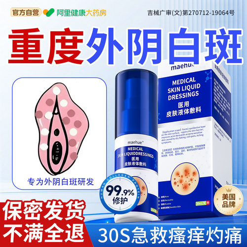 【胖东來热销】一喷急救外阴白斑