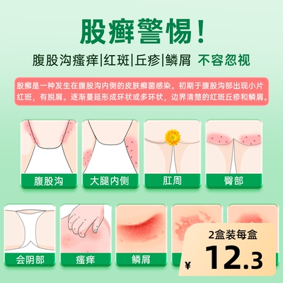 【自营】【恩威】联苯苄唑乳膏1%*15g*1支/盒⭐股癣体癣真菌感染