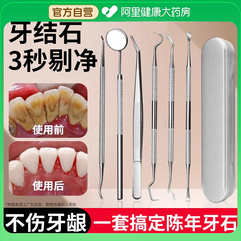 牙结石去除器牙齿清洁口腔镜子神器污垢牙医工具专用牙科修剔牙针