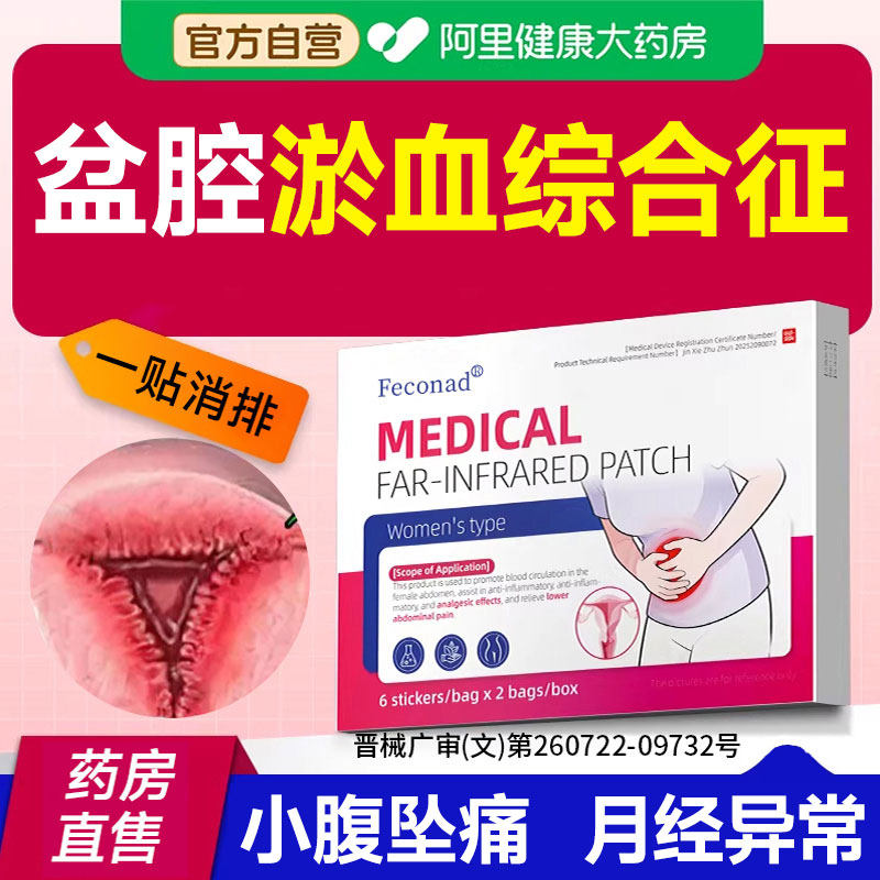 盆腔淤血综合征静脉曲张盆腔炎积液月经白带异常膏药远红外子宫