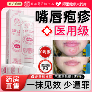嘴唇疱疹干裂起泡嘴巴唇炎唇膏口角炎上火医用级聚乙二醇护创敷料