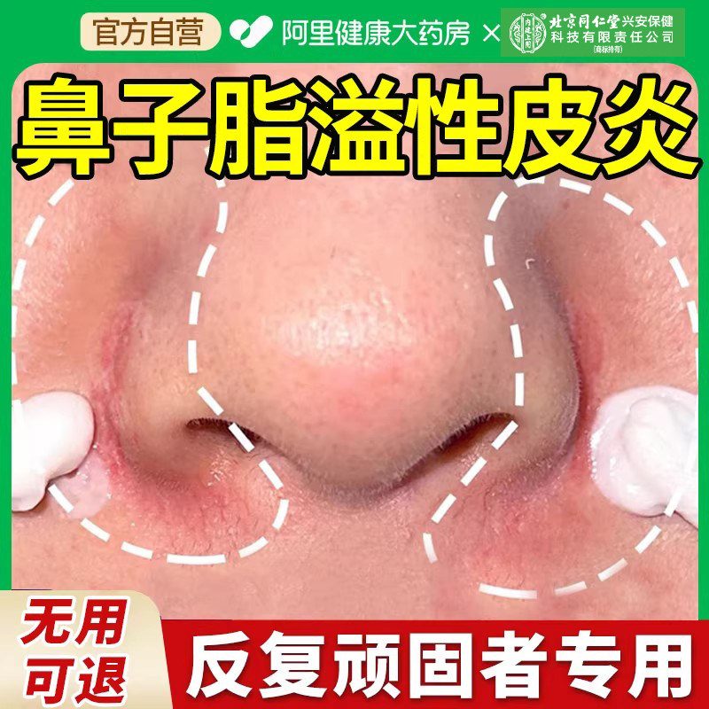 鼻子脂溢性皮炎鼻翼两侧非修复面部脸上皮肤干燥起皮脱皮软膏,医疗器械,保健理疗,淘宝优惠券,粉丝福利购,淘宝优惠卷