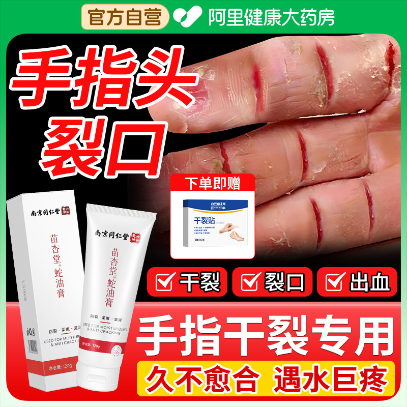 手指头裂口子脱皮开裂干裂修复霜秋冬指甲缝指尖开裂防皲裂愈合膏