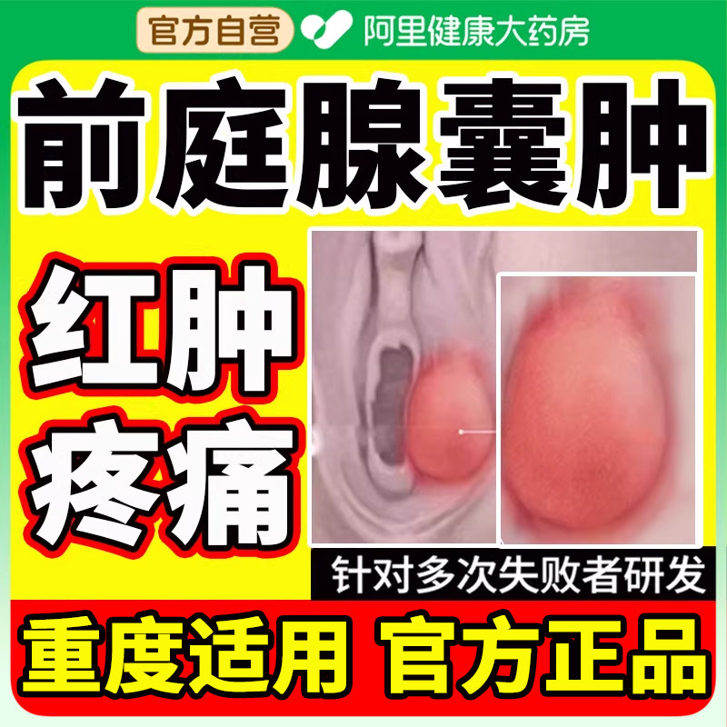 外阴前庭大腺巴氏囊肿非疏通有疙瘩肿痛火疖子脓包疖肿痘痘特止痒