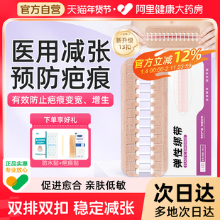 医用拉链式减张器甲状腺剖腹产减张贴术后伤口愈合免缝疤痕减张