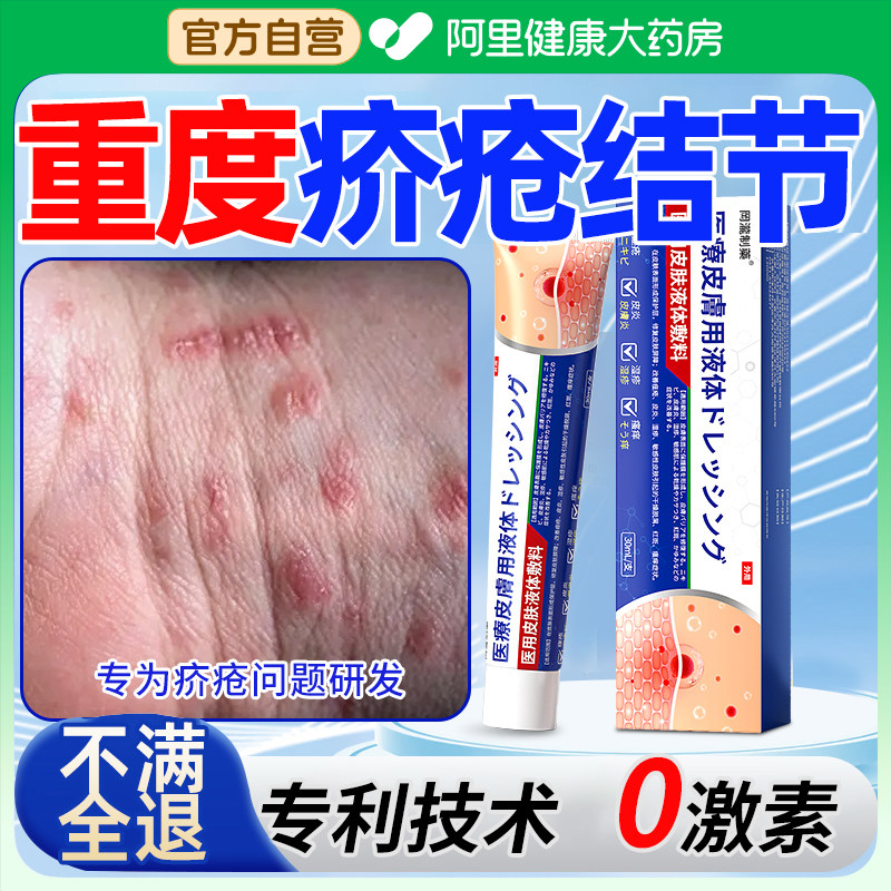 疥疮治疗疥疮结节皮肤瘙痒男性阴囊潮湿乳膏消毒杀小疥虫正品特药