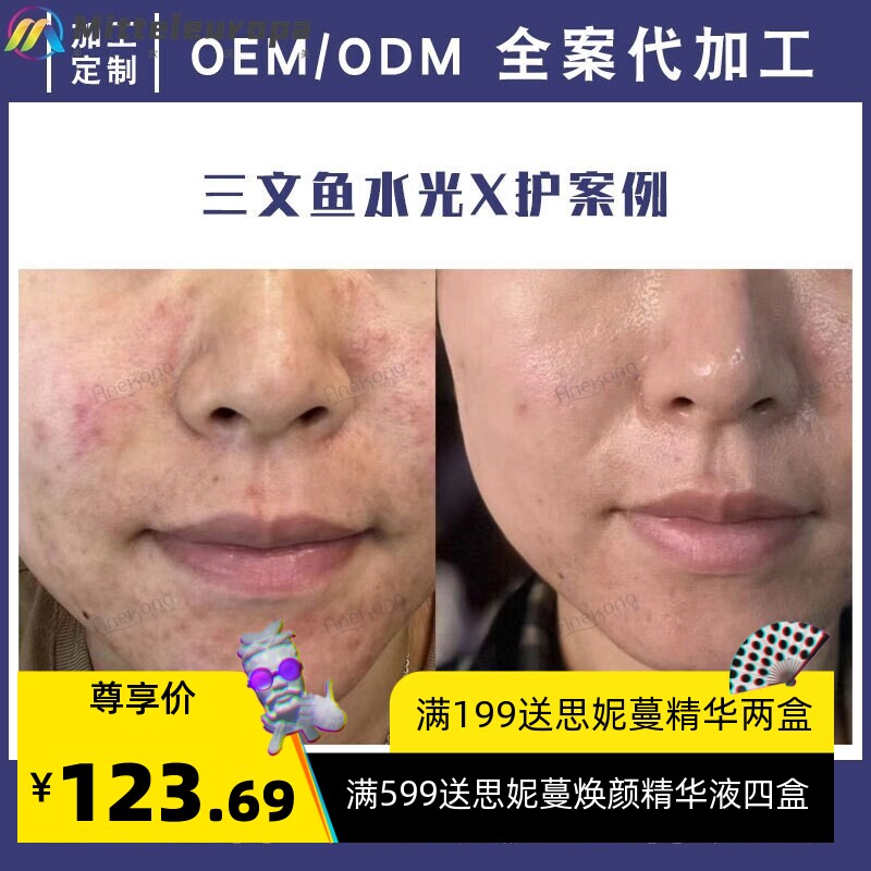 美容院补水嫩肤修护水光原液套盒 深导DNA钠婴儿肌PDRN三文鱼水光