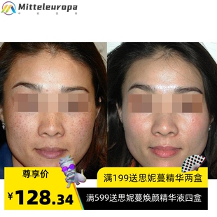 疏基水臭臭水祛黄褐斑排铅汞改善激素脸提亮肤色美容院巯基蛋白套