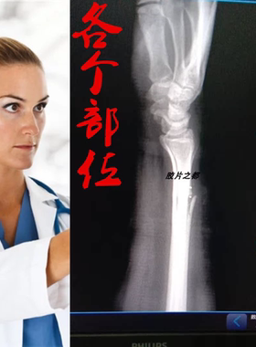 医用胶片喷墨蓝片干式CT DR CR 牙科骨折定制X光片放射科打印胶片