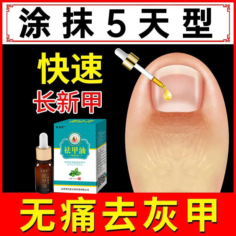 脚趾甲灰甲净换新官方正品脱甲膏包甲套杀菌液抑菌灰指甲手指甲药