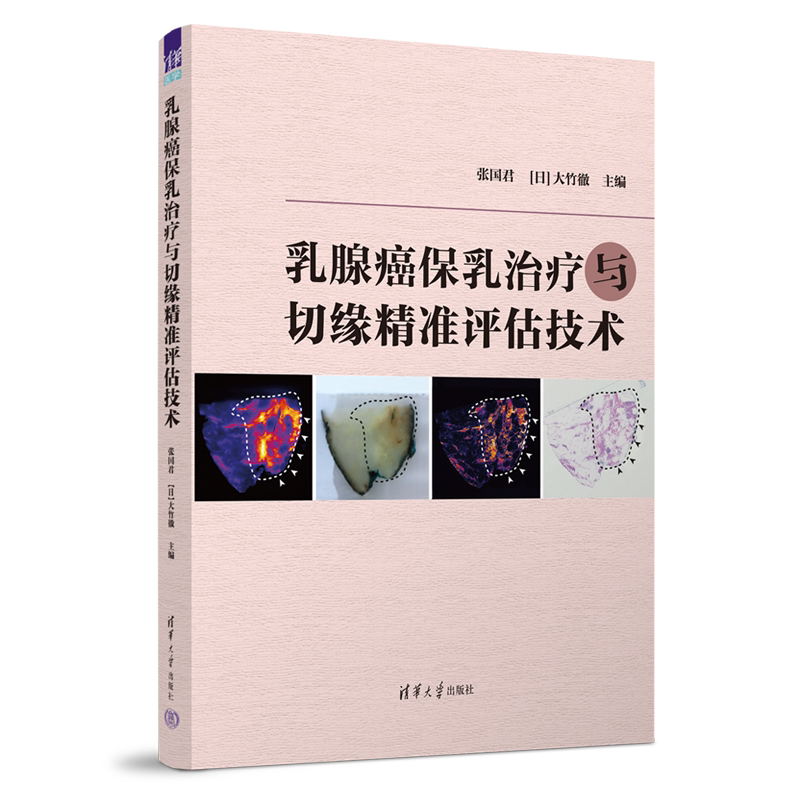乳腺癌保乳治疗与切缘