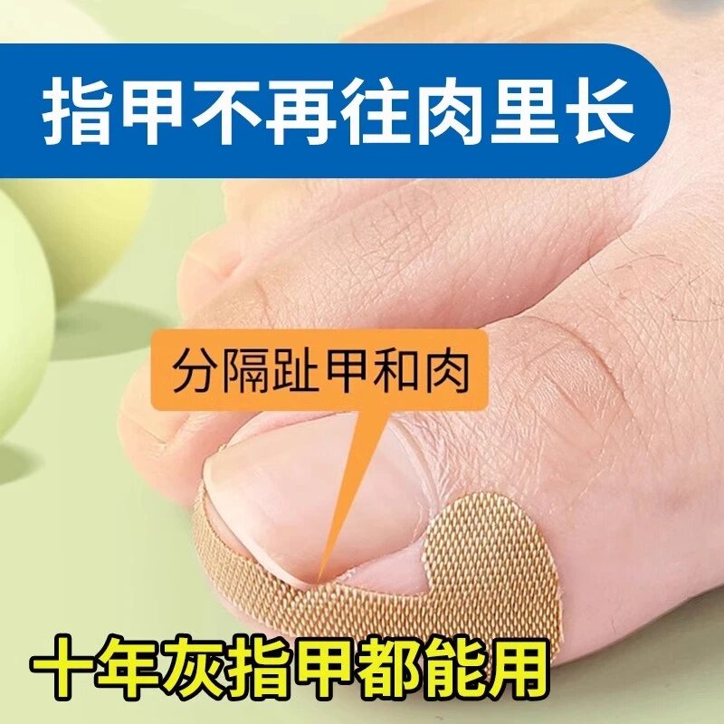 【指甲矫正贴】无痛矫正高力回弹