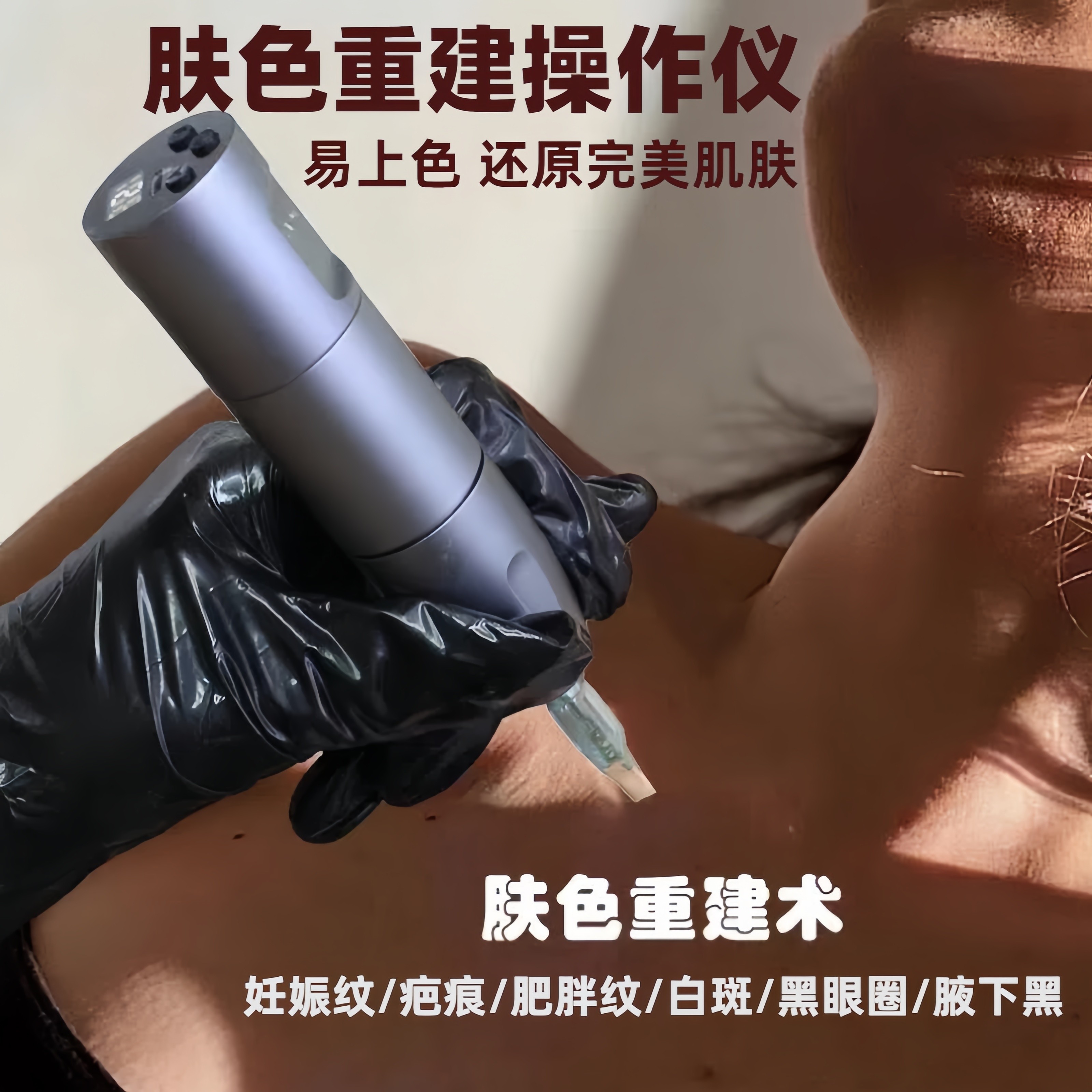 纹绣黑眼圈遮盖妊娠纹生长纹肥胖纹白斑肤色还原肤色肤色重建仪器