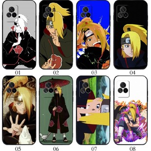 X60 U3x 适用vivo 18X 一加 S9e手机壳 迪达拉 GT2 曲屏版 魅族 realme iQOO Ace Neo3