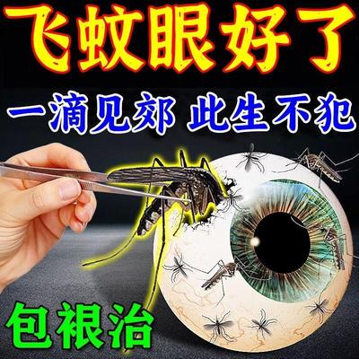 飞蚊症专用滴眼液治疗眼前黑影飘动眼睛浑浊模糊叶黄素进口眼药水