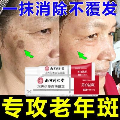 去老年斑的药膏强力去除脸部手部手臂专用中老年人黑班黄褐斑的药